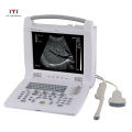 MT Medical China Digital Portable Veterinary Ultrasound Price